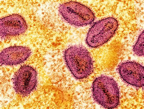 carpark at manila doctor’s hospital|DOH detects 2 more mpox cases in Metro Manila.